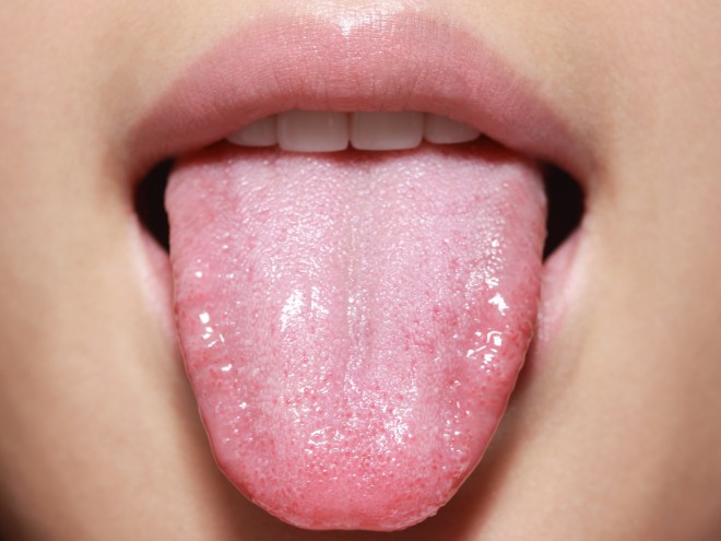 A girl poking her tongue out.
